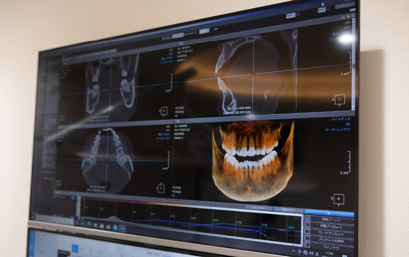 先端歯科機器を揃え、正しい精密な治療を行う体制