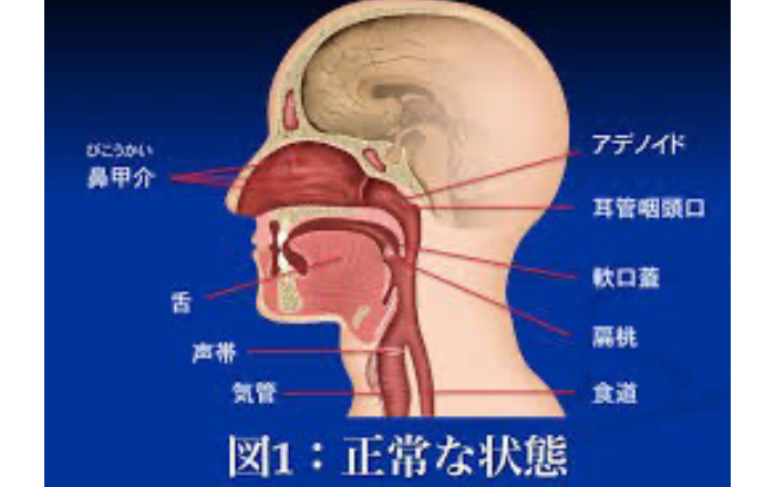 アデノイド顔貌とは？