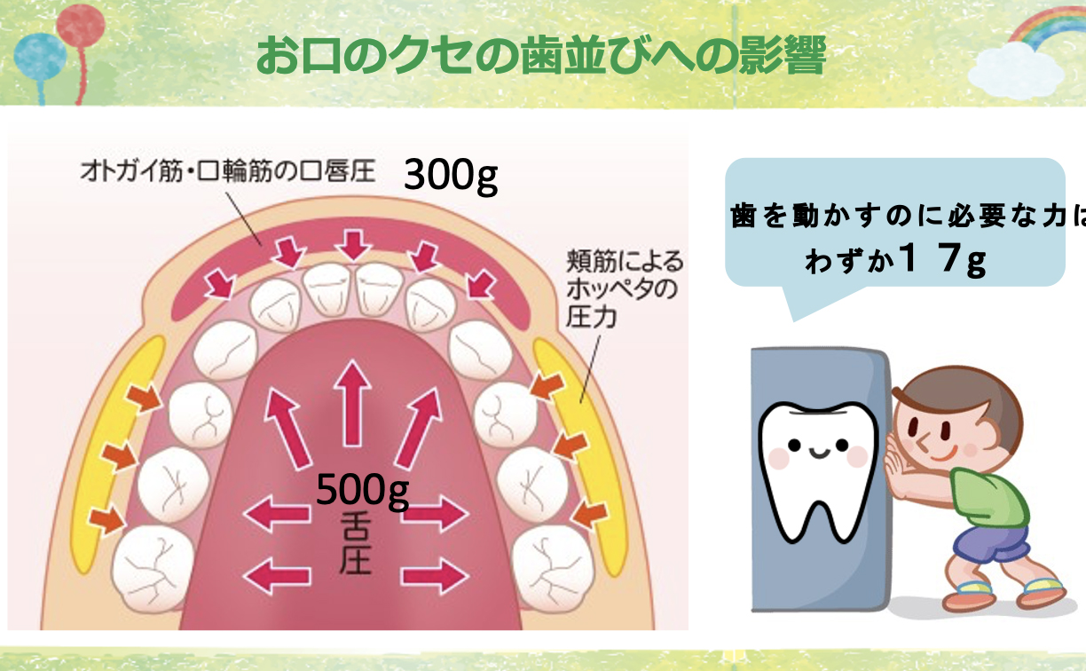 歯並びの影響