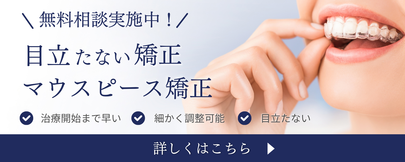 マウスピース矯正